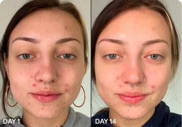 Common Skincare Myths You Need to Stop Believing